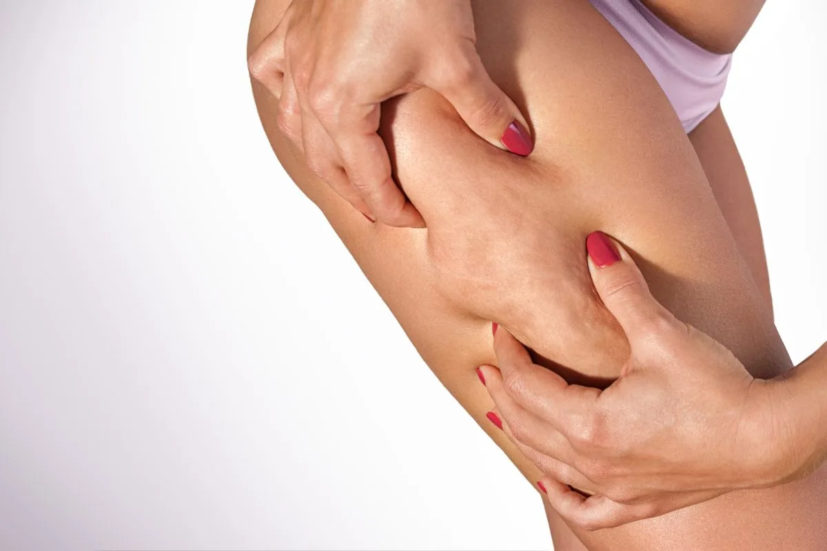 Cellulite oel