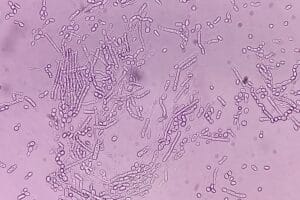 Dermatophyten