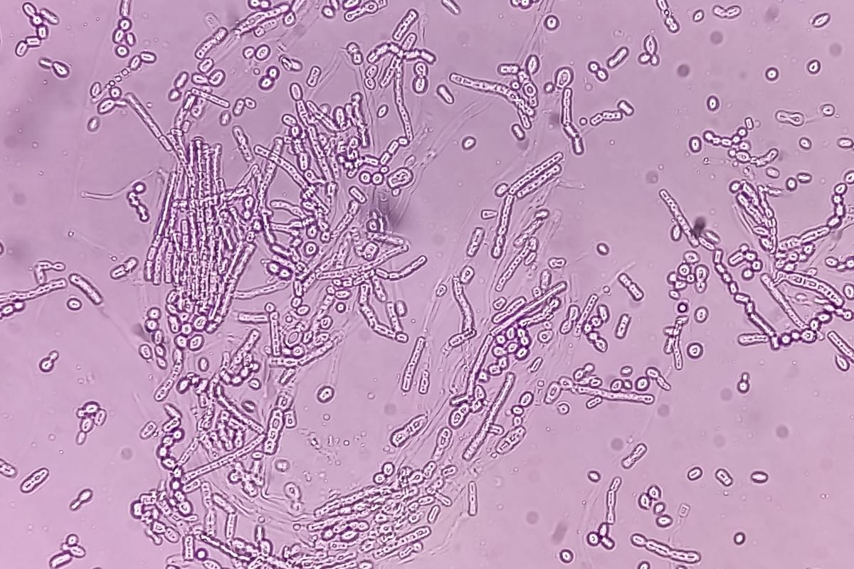 Dermatophyten