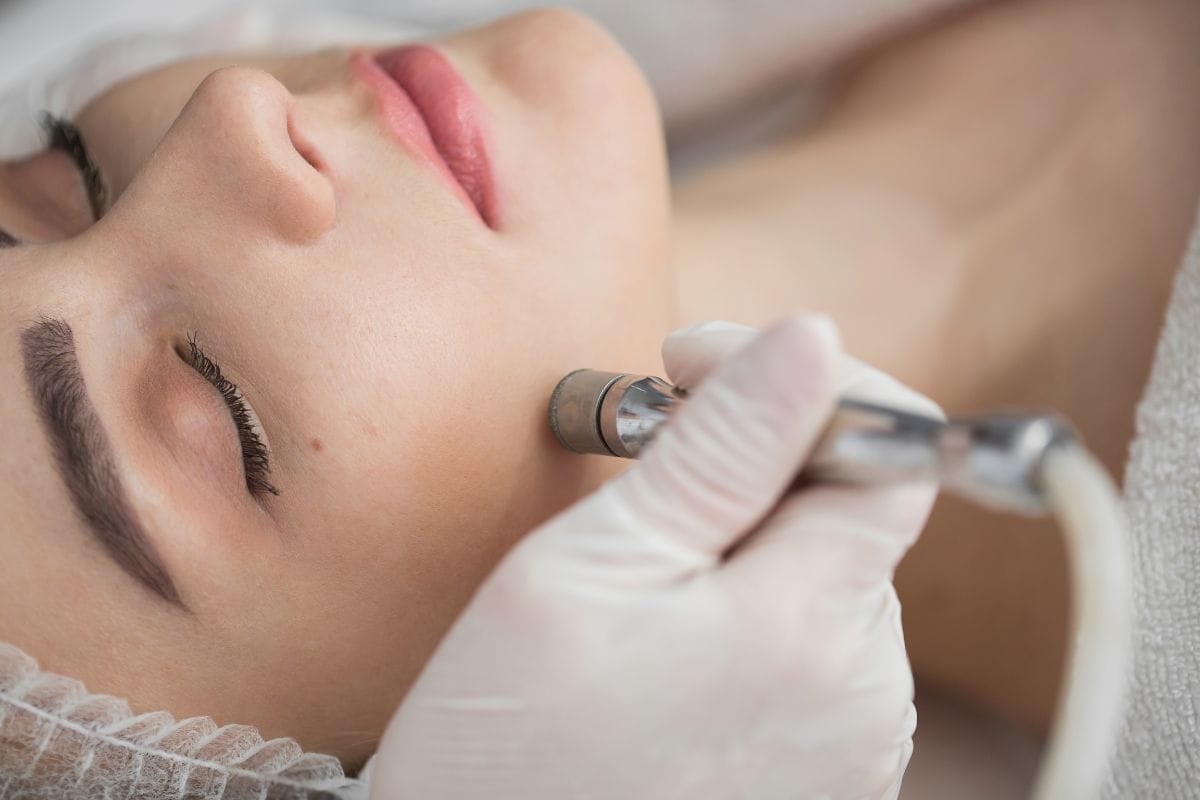 Diamant Mikrodermabrasion
