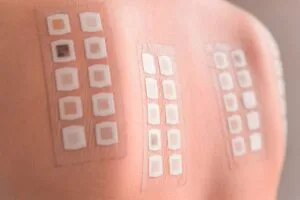 Epikutantest
