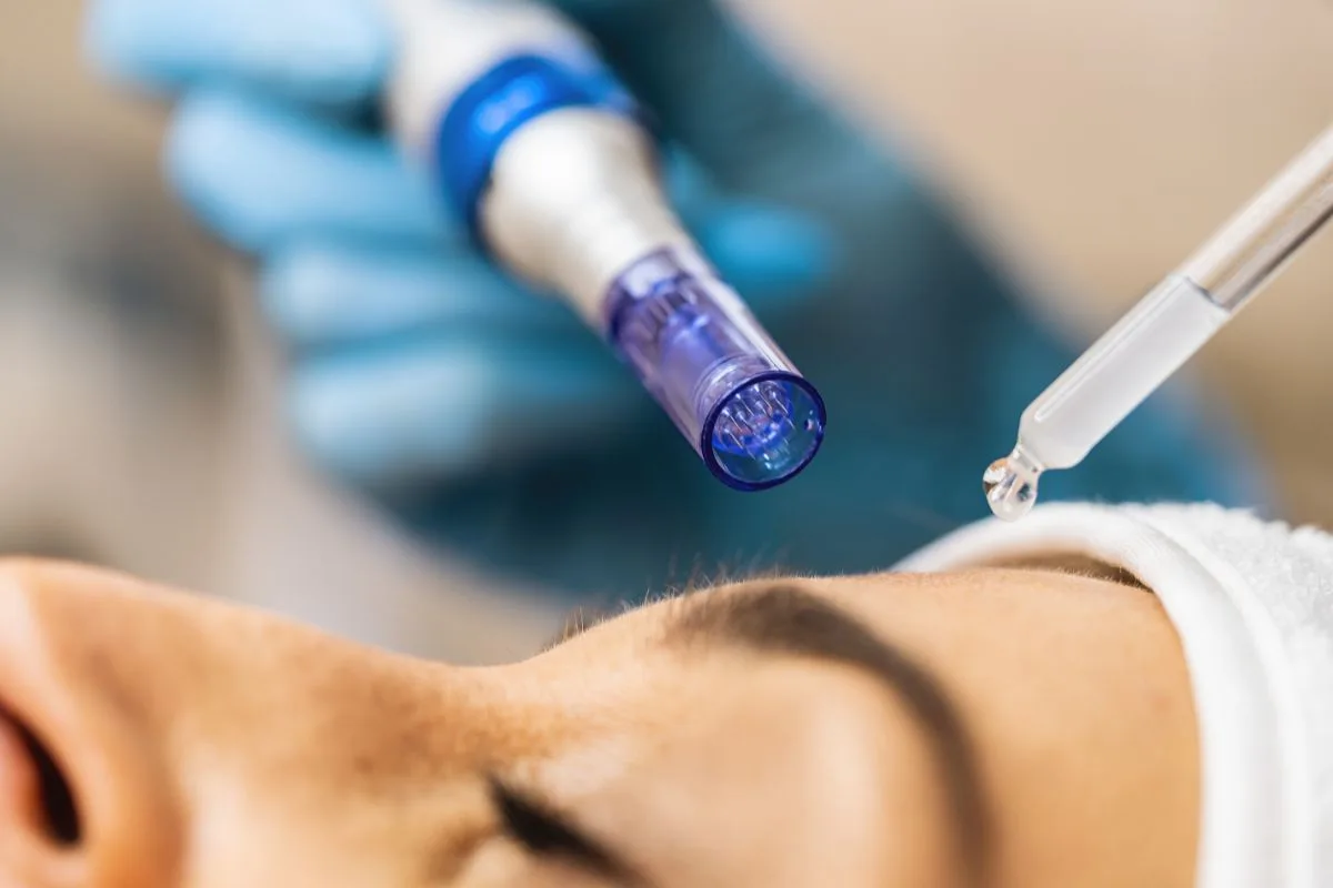 Microneedling Pen