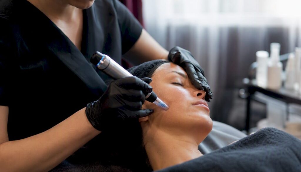 Nahaufnahme: Hände führen eine Microneedling-Behandlung durch