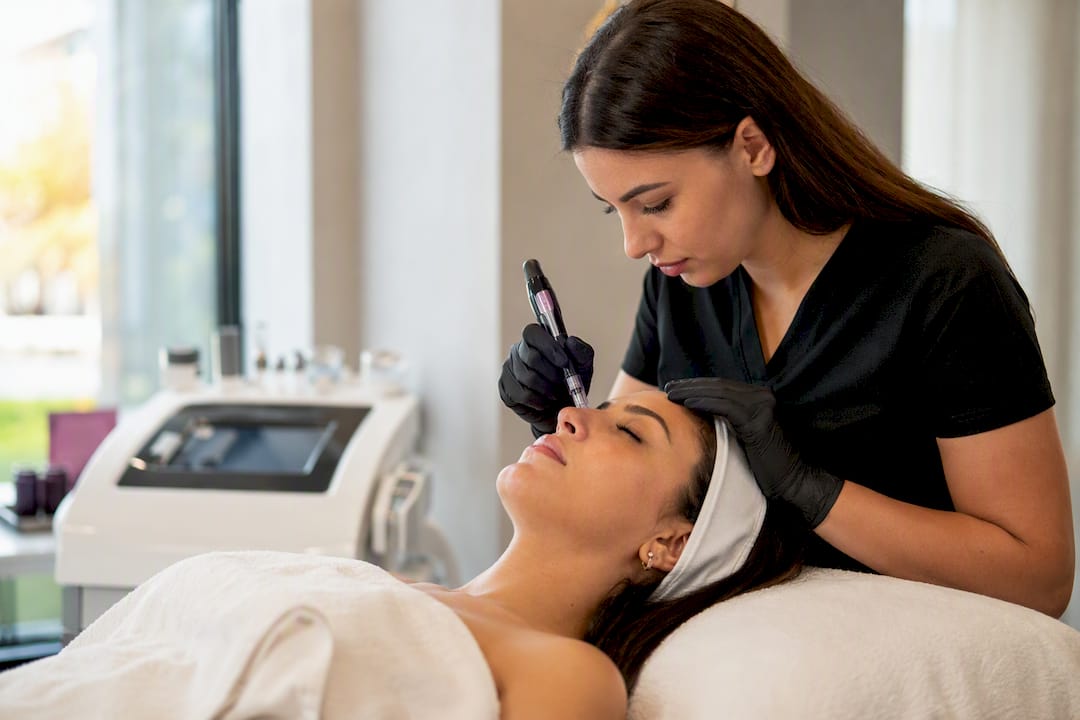 Hände führen Microneedling-Behandlung durch