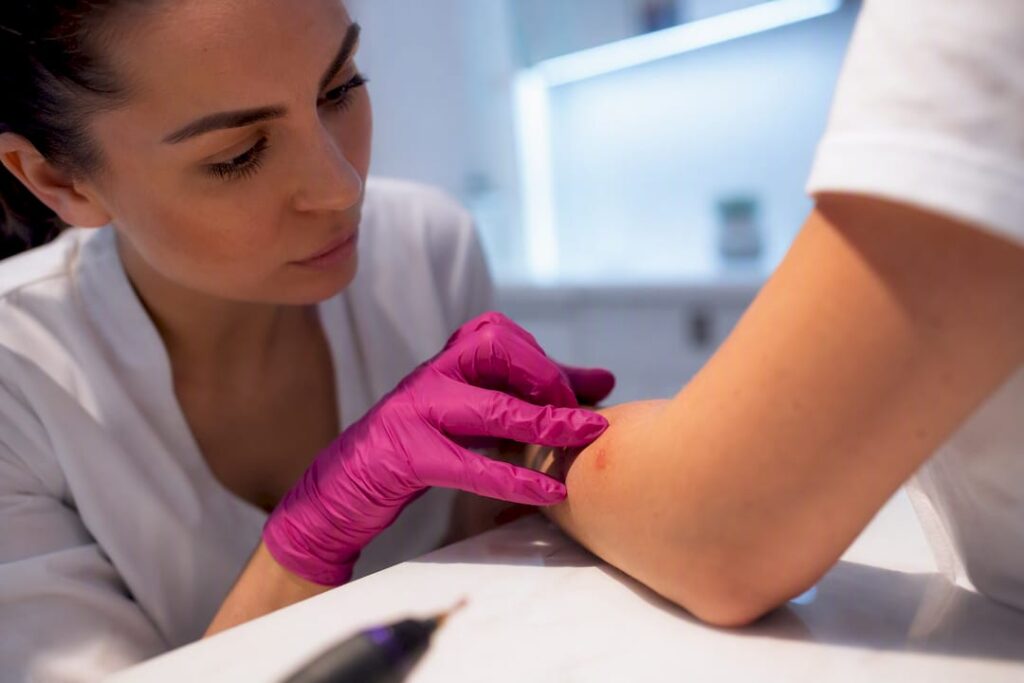 Überprüfte Hautpartie neben der Spitze des Plasma-Pens