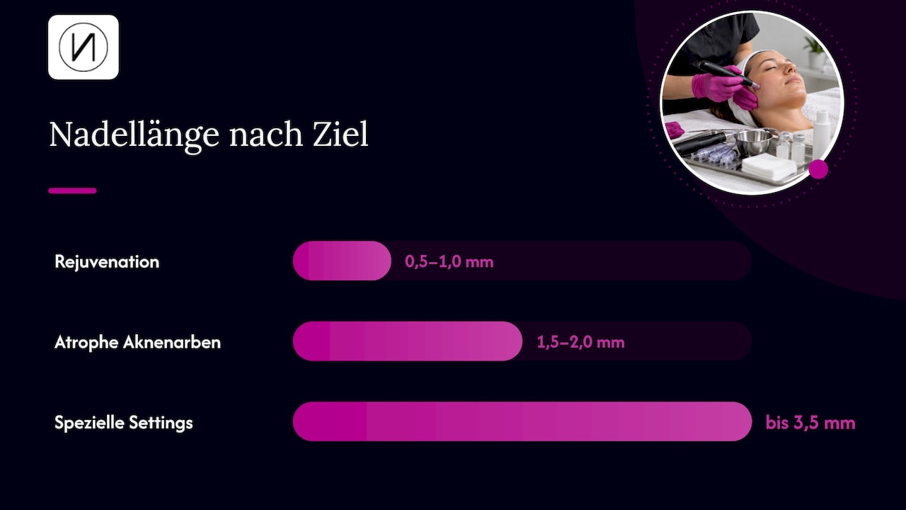 Nadellänge, Gerät, Intervall: So sieht ein sinnvolles Protokoll aus — overview diagram