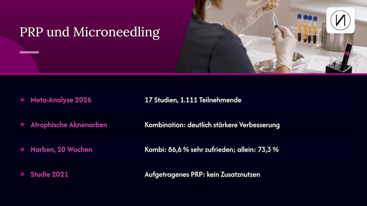Plasma Pen oder Microneedling? Der ehrliche Vergleich 2026 2 Und was ist mit Plasma, also PRP? — overview diagram